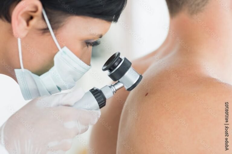 Quels sont les meilleurs professionnels pour enlever un grain de beauté à Cosne-sur-Loire 32 un dermatologue examinant un grain de beaute